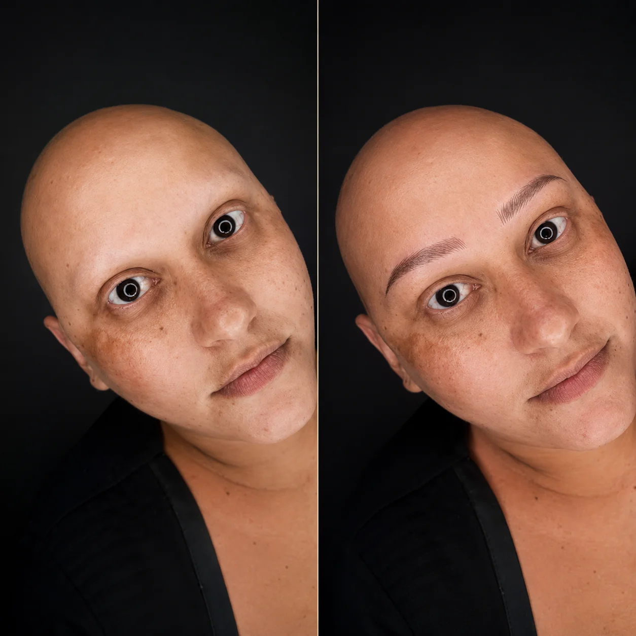 Antes e depois de uma cliente da Fabiana Alves após reconstrução de sobrancelha